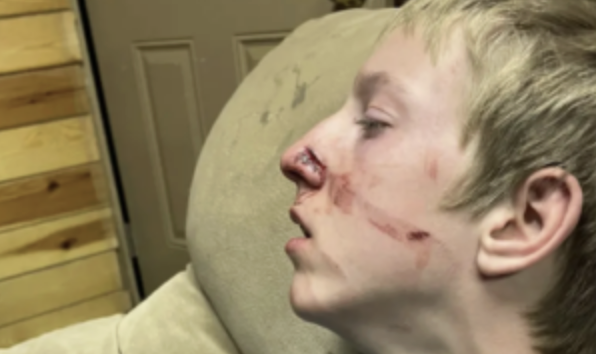 Maybe the Bear Wouldn’t Have Been Messing with the Kid If He Didn’t Look Like Such a Pussy?